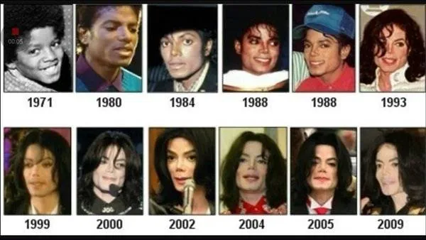 Сколько пластических операций сделал Майкл Джексон: Печальная история с фото до и после