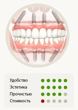 Протез All-on 4 решение под ключ