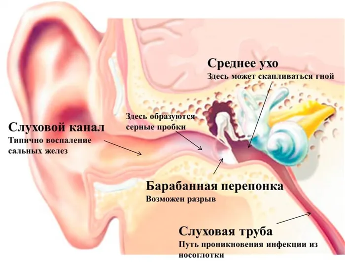 признаки перелома уха