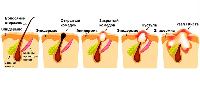 ретиноиды