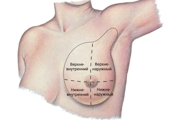 Деление груди на квадранты