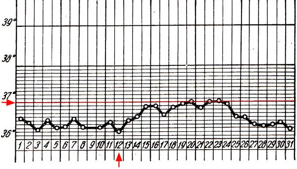 График базальной температуры при хроническом эндометрите